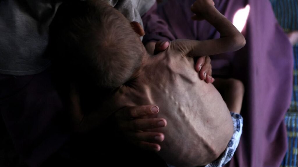Gaza ‘Starvation’: WHO says malnutrition reaching alarming levels