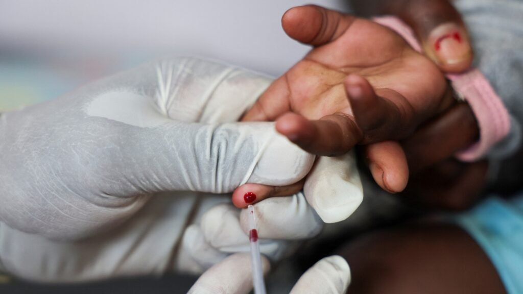 How can countries save the lives of people living with HIV? | Health