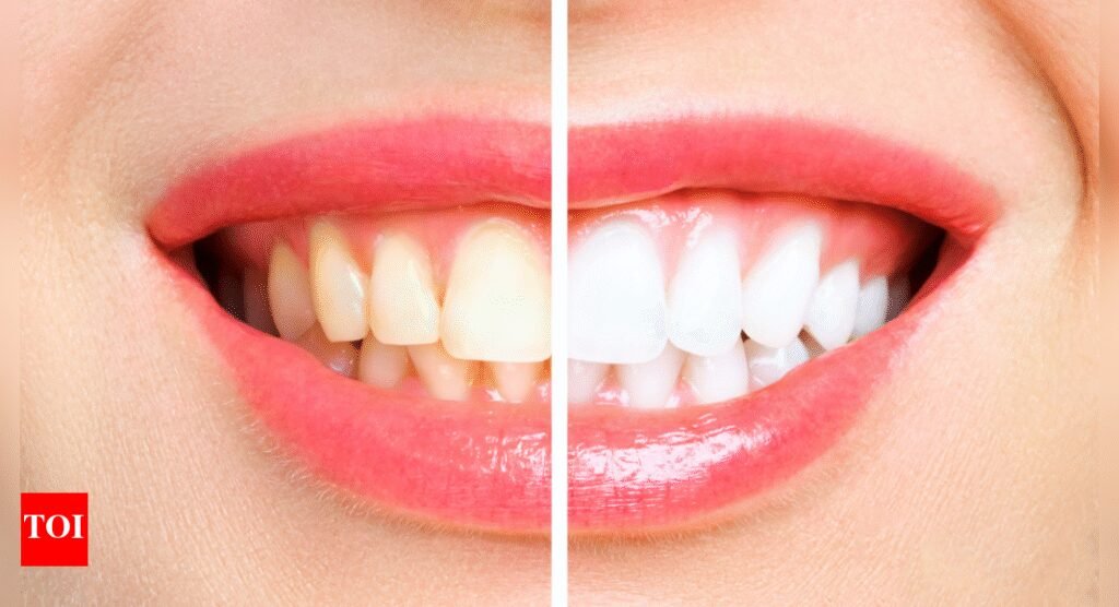 How to remove yellow stains from teeth: 3 tips that always work