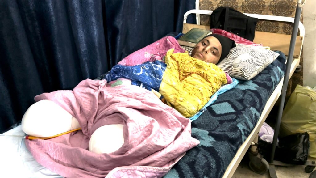 Palestinian girl recounts losing legs and family in Israeli attack in Gaza