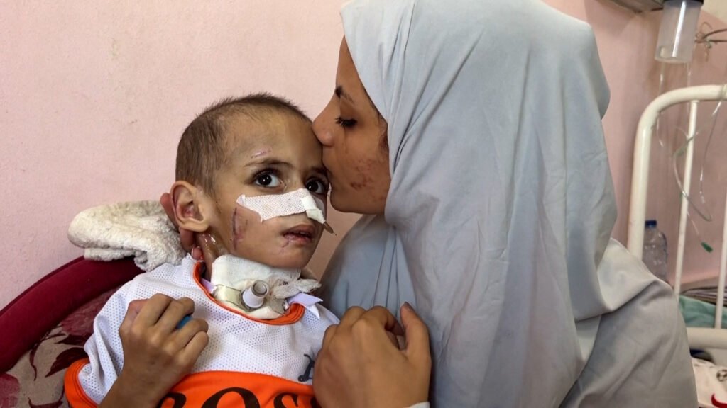 Paralysed 3-year-old’s suffering worsens after Israeli attack in Gaza | Gaza