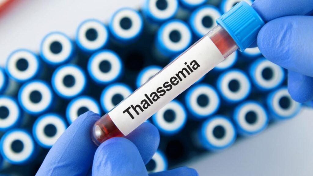 Thalassemia patients call for standardised tests to reduce transfusion-transmitted infections 