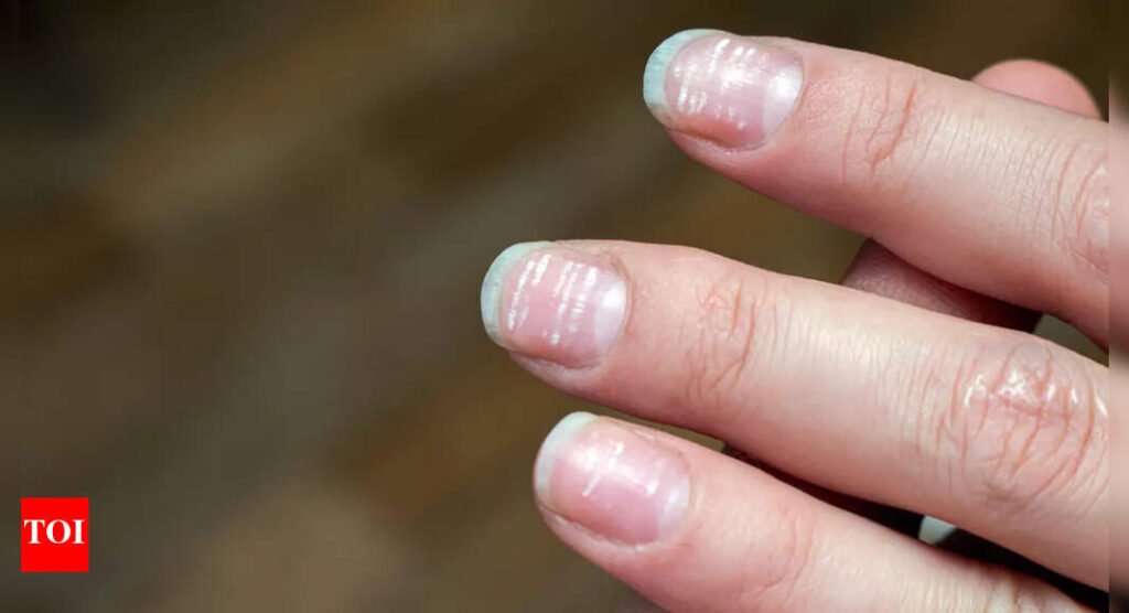 What are the tiny white spots on the nails? Top functional medicine doc says it could be a warning sign |