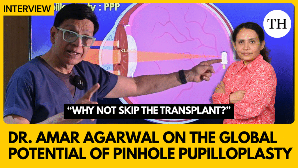“Why not skip the transplant?”: Dr. Amar Agarwal on the global potential of Pinhole Pupilloplasty