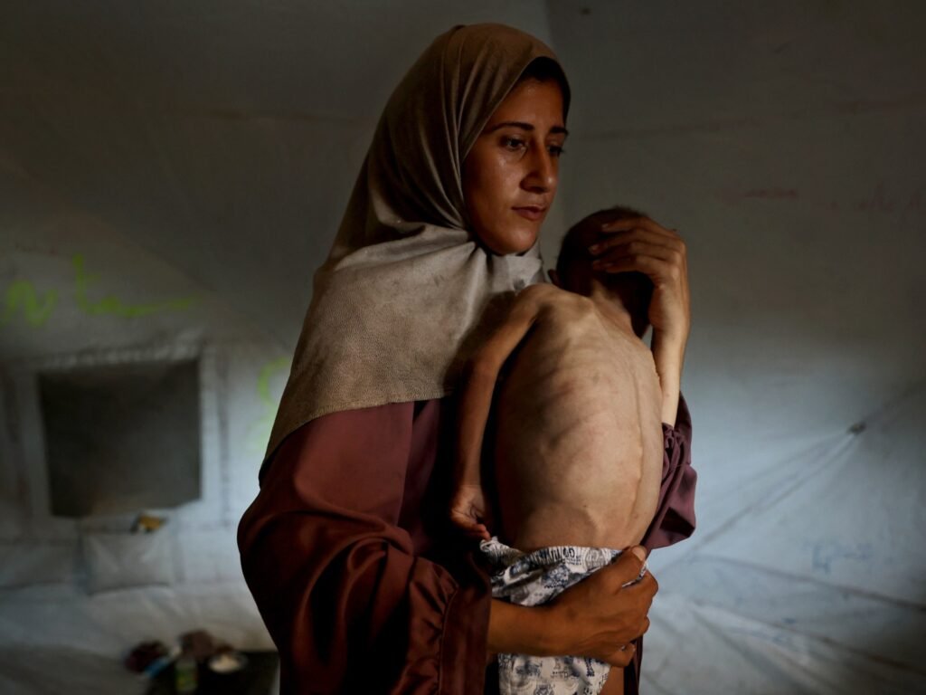 ‘Not eating for days’: Gaza’s worsening starvation crisis | Israel-Palestine conflict News