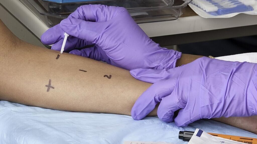 Allergies in children can manifest in different forms: how early identification and careful management can help