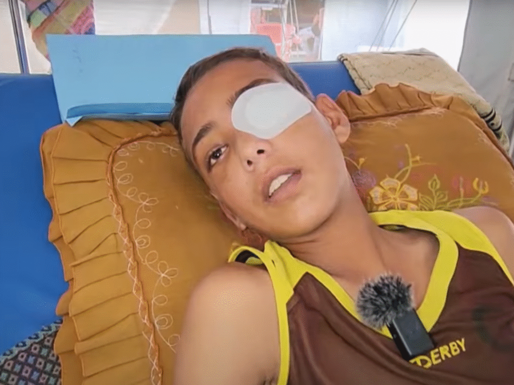 Israel forces shoot Palestinian boy in eye at aid site amid Gaza starvation | Israel-Palestine conflict News