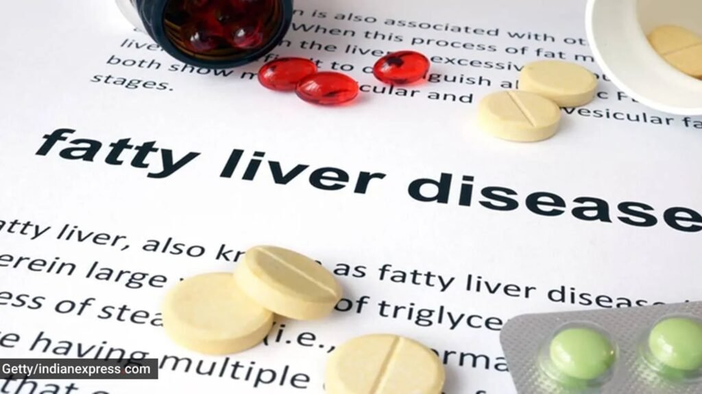 What makes fatty liver disease (NAFLD) such a strong risk factor for liver cancer